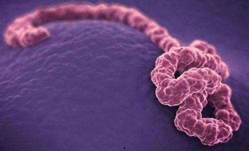 伊波拉病毒在线观看,在线观看揭示致命疫情真相